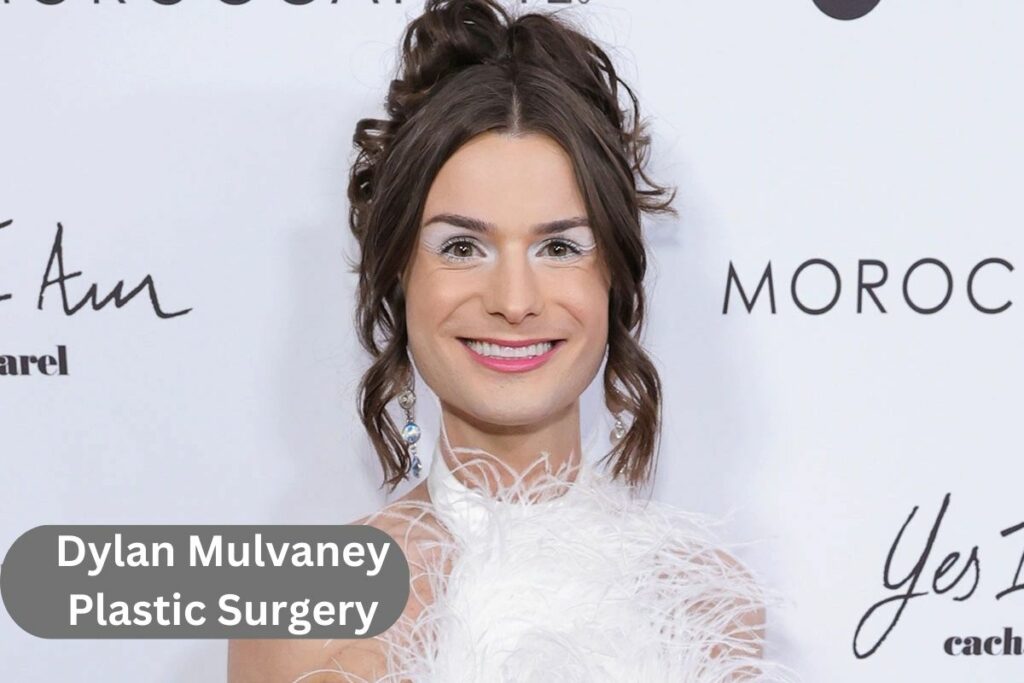 Dylan Mulvaney Plastic Surgery