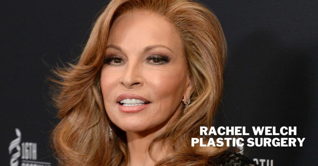 Rachel Welch Plastic Surgery