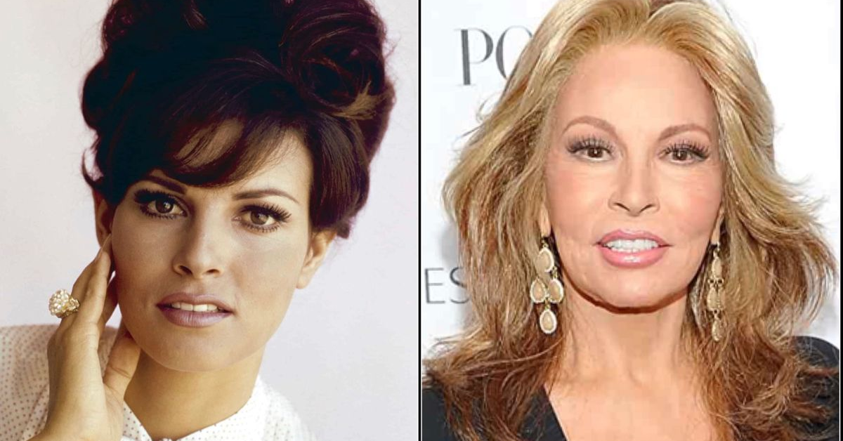 Raquel Welch Plastic Surgery