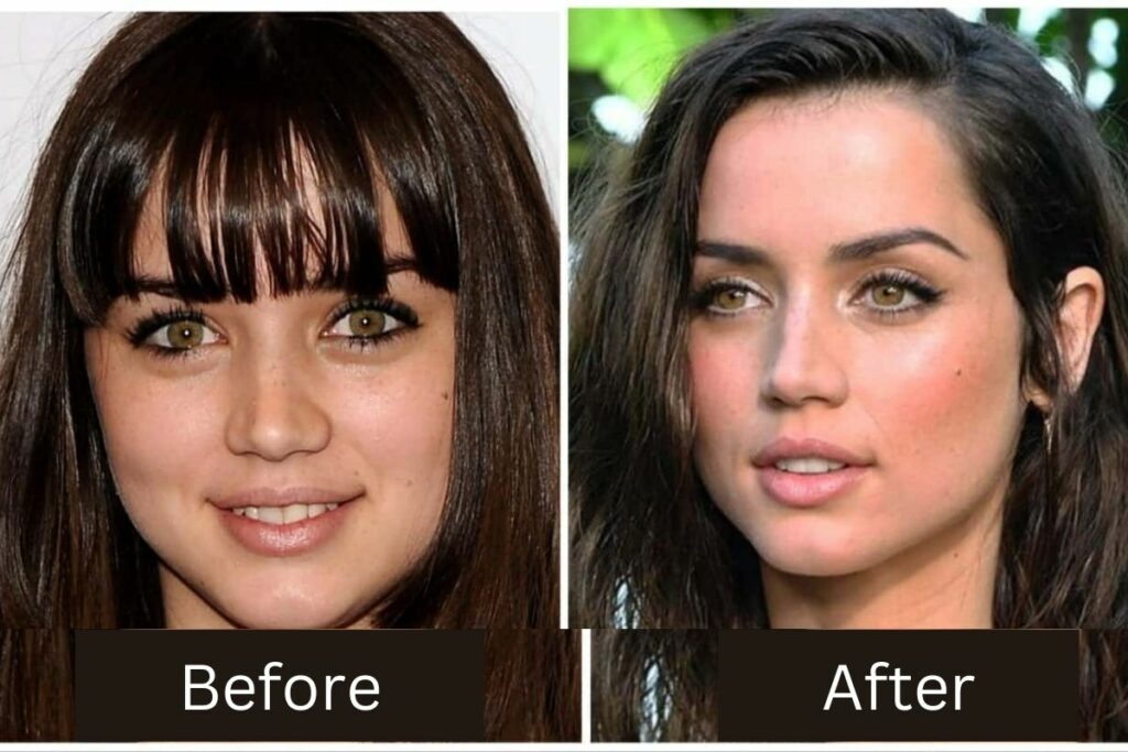 Ana De Armas Plastic Surgery Before and After Transformation