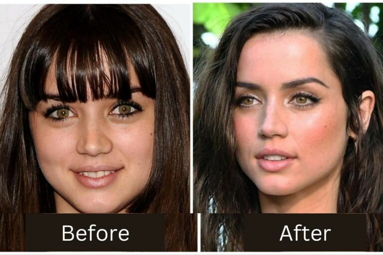 Ana De Armas Plastic Surgery: Before and After Transformation