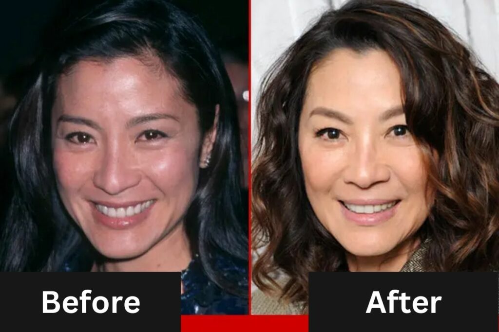 Michelle Yeoh Plastic Surgery Before and After Look