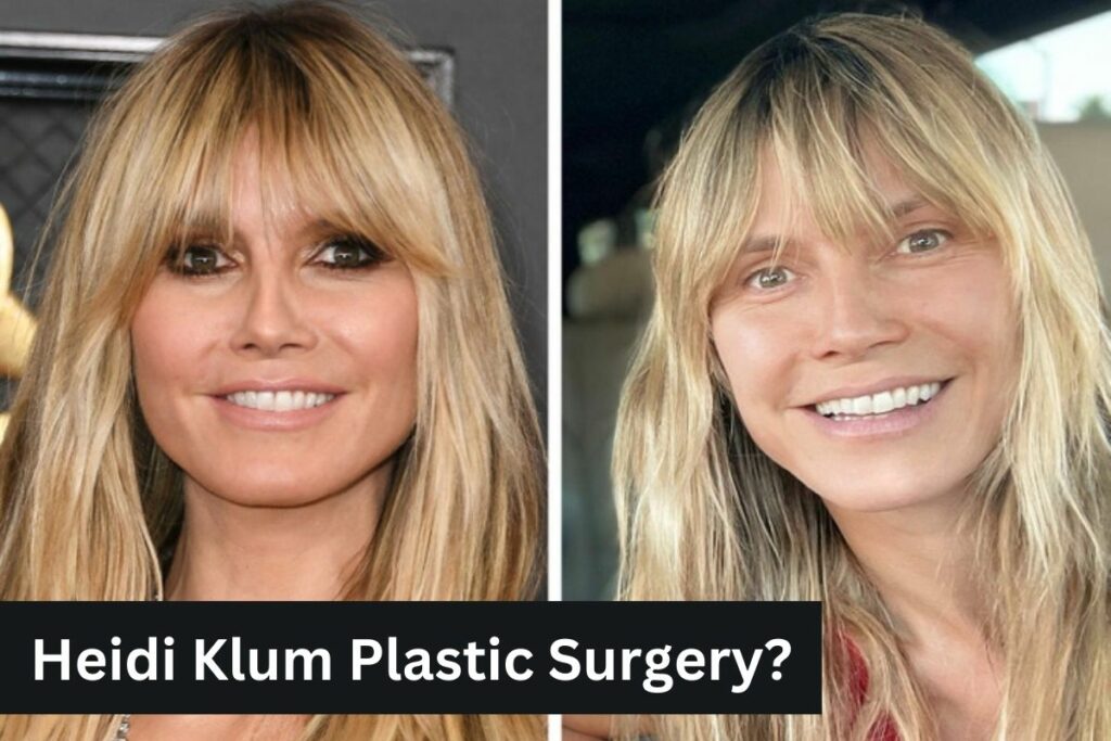 Heidi Klum Plastic Surgery Facelift Gossip Examined Here!