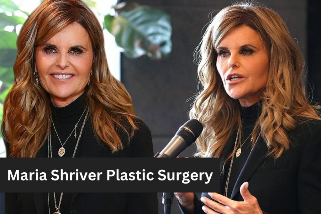 Maria Shriver Plastic Surgery is She No Longer Recognizable