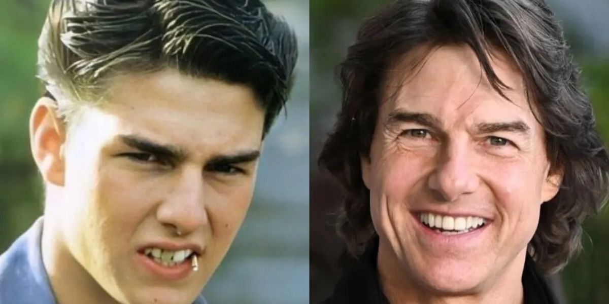 Tom Cruise did many early auditions with a chipped tooth.